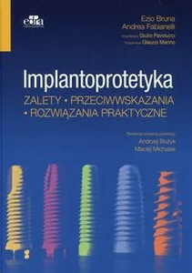 Implantoprotetyka Zalety przeciwwskazania rozwiązania praktyczne