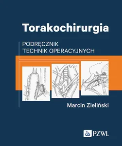 Torakochirurgia Podręcznik technik operacyjnych Torakochirurgia Podręcznik technik operacyjnych
