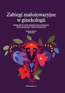 Zabiegi małoinwazyjne w ginekologii Podręcznik do nauki zabiegów laparoskopowych histeroskopowych i operacji robotowych