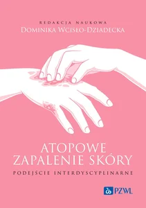 Atopowe zapalenie skóry Podejście interdyscyplinarne Atopowe zapalenie skóry Podejście interdyscyplinarne